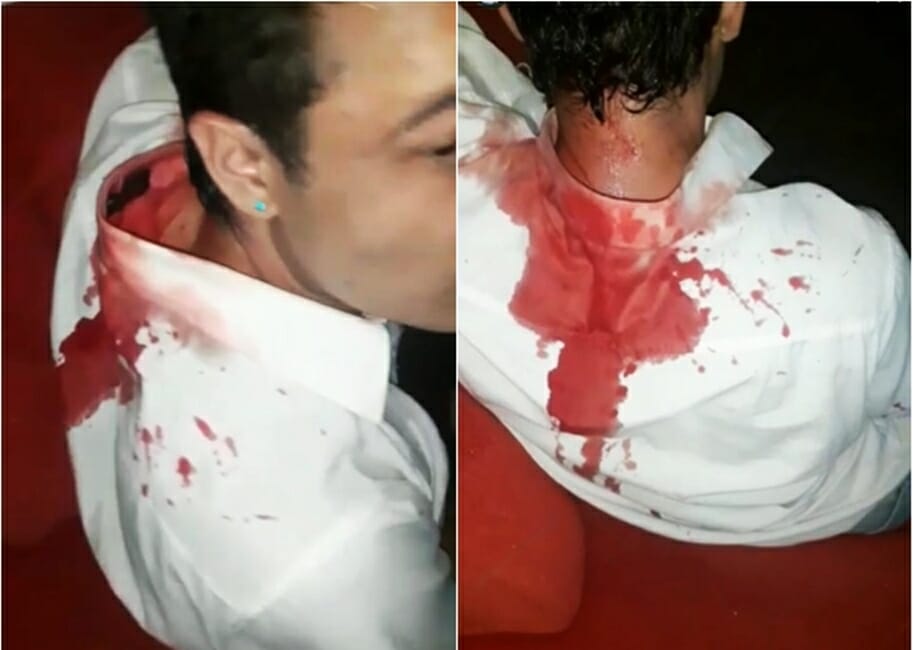 Imagens mostram rapaz após ser agredido