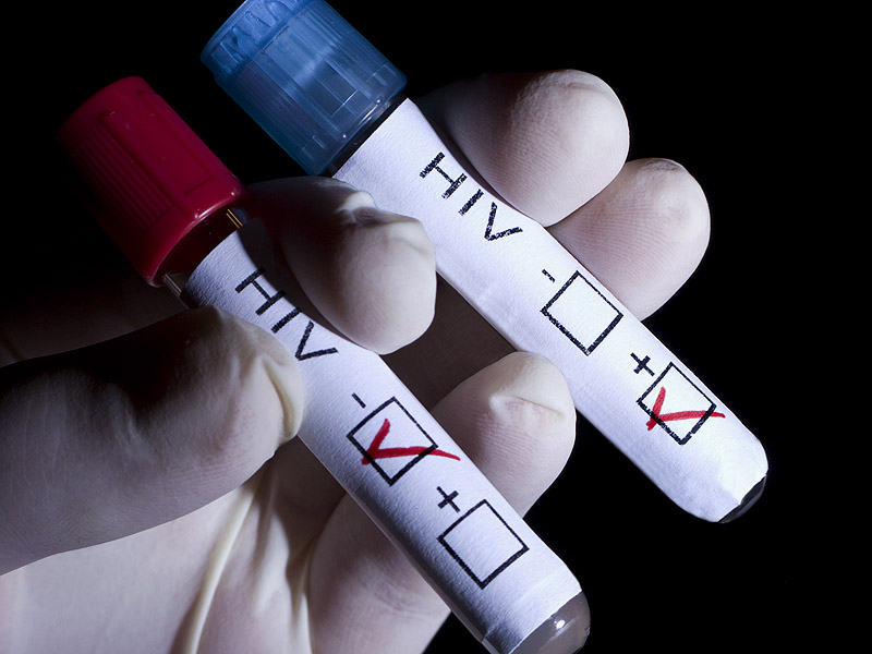 Apesar de demonstrar 99,9% de sensibilidade e efetividade, o teste só poderá indicar a presença do vírus 30 dias depois da situação de exposição
