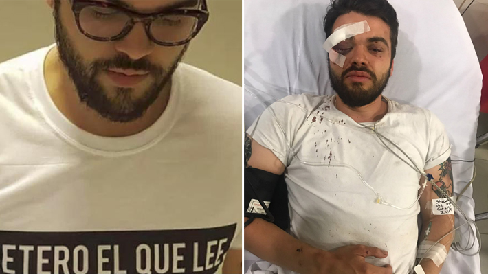 Jogador de rúgbi argentino foi brutalmente espancado, vítima de homofobia