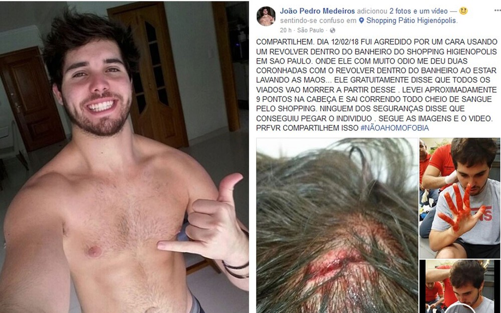Ator relata ser vítima de violência homofobica em shopping de Sao Paulo