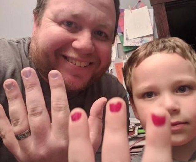 Aaron (pai) pinta as unhas em solidariedade a Sam que sofreu bullying na escola