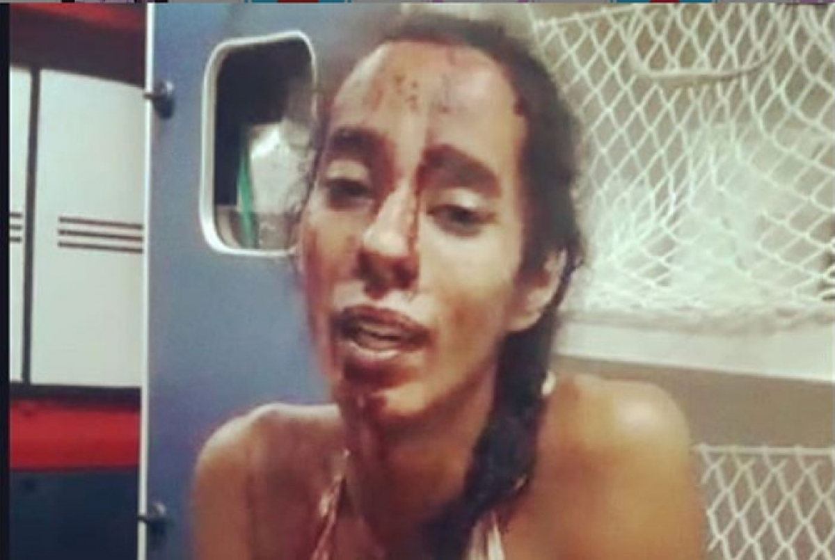 Mulher transexual denuncia agressão de grupo em Niterói