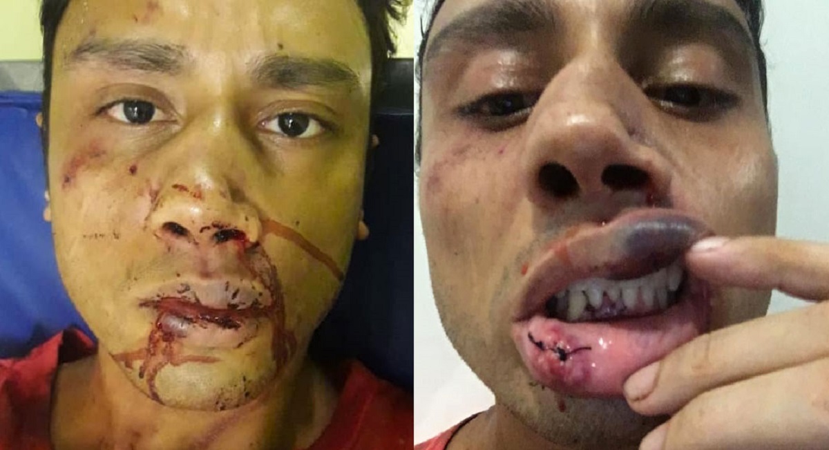Jovem carioca Jonatas Dias agredido por seis homens homofóbicos