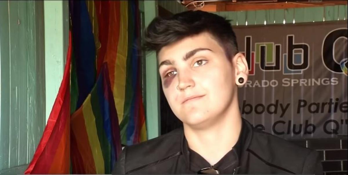 O jovem trans Emmit Davis foi brutalmente espancado nos EUA por ser gay e afeminado