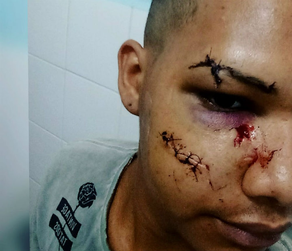 Jovem dias após a agressão em Juazeiro, no norte da Bahia — Foto: Arquivo Pessoal