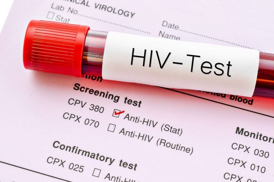 Teste de HIV (Ilustrativa)