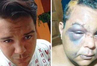 Caio Lopes foi espancado e teve a moto roubada. Bandidos disseram que cometeram crime por ele ser gay