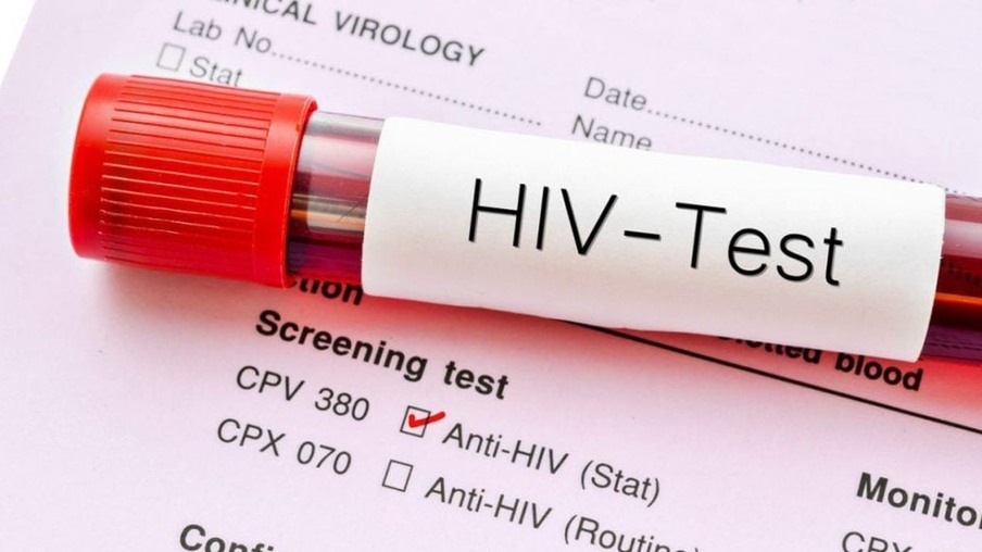 Teste de HIV (Ilustrativa)