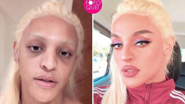 Pabllo Vittar antes e depois da transformação