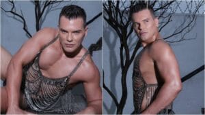 Após realizar botox peniano, ex-apresentador do SBT, Israel Cassol, é estrela de reality show inglês sobre procedimentos estéticos